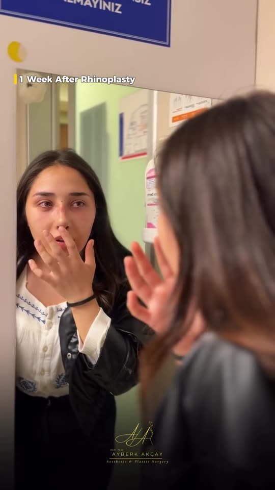 A patient seeing her nose in the mirror, one week after rhinoplasty